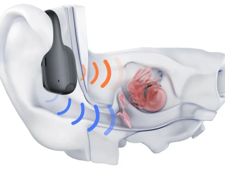Shokz Bone Conduction Kopfhörer OpenRun Pro 2 Mini USB-C Schwarz